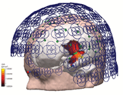 C6_MEG_EEG_SimunewBIG.gif